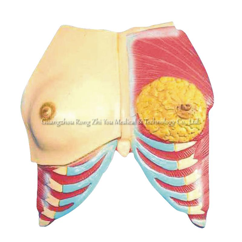 Anatomical Breast model Anatomical Breast model