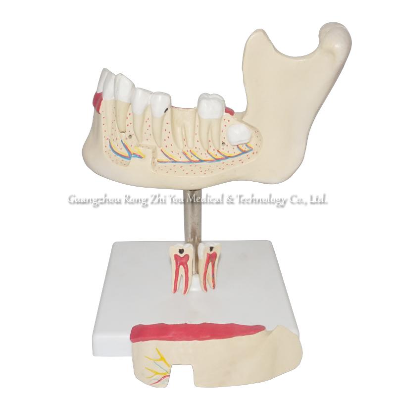 Teeth and Jaw Model