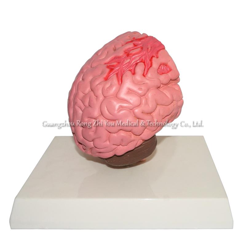 brain stroke demonstration model