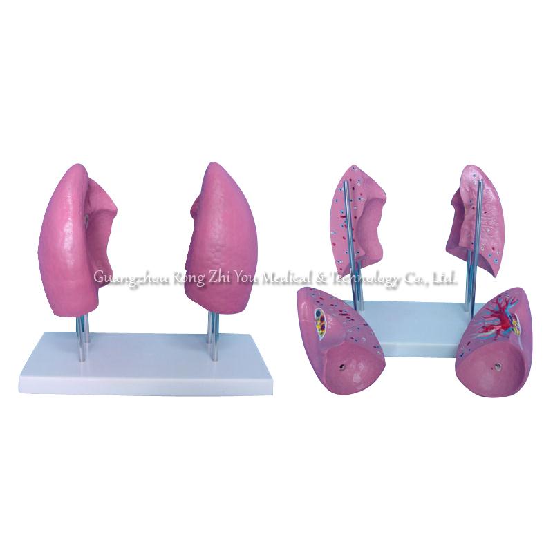 Lung Model