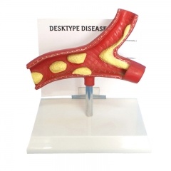 modelo vascular patológico