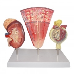 modelo renal