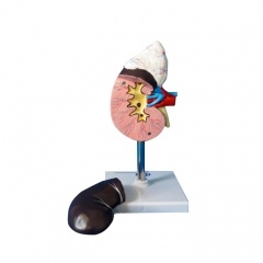 modelo de riñón humano