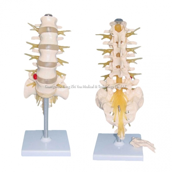 modelo de vértebra lumbar
