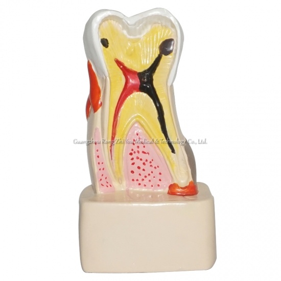 modelo dental patología