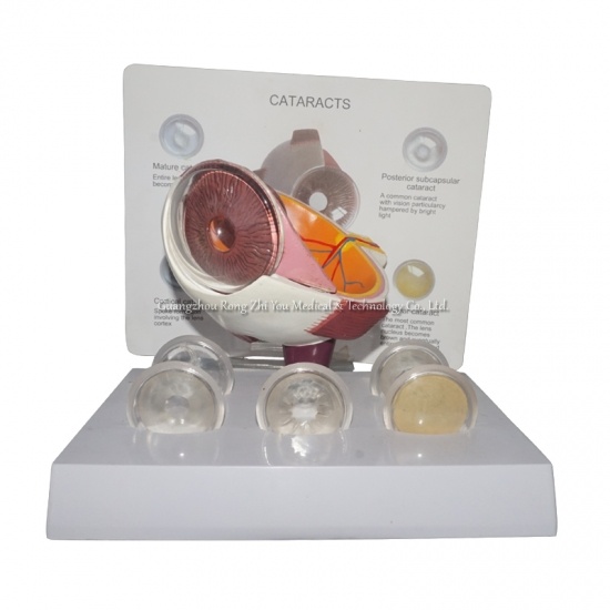 modelo anatómico de la córnea ocular