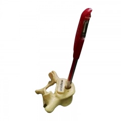 portalápices de vértebras lumbares