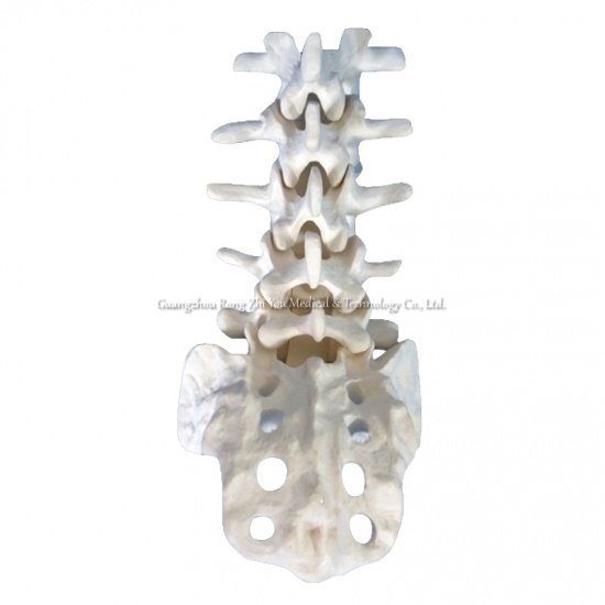 modelo de anatomía de la columna lumbar