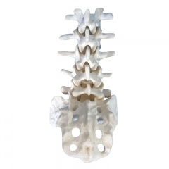 modelo de anatomía de la columna lumbar