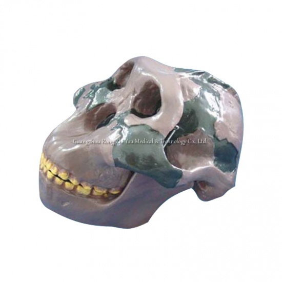 enseñanza médica cráneo humano