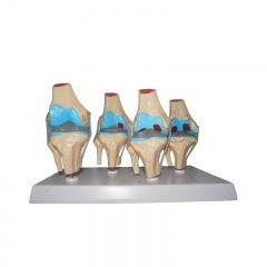 modelo de estructura de articulación de rodilla