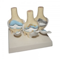 modelo de articulaciones de rodilla humana