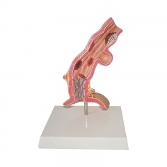 modelo de enfermedad esofágica