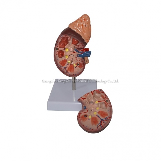 modelo renal