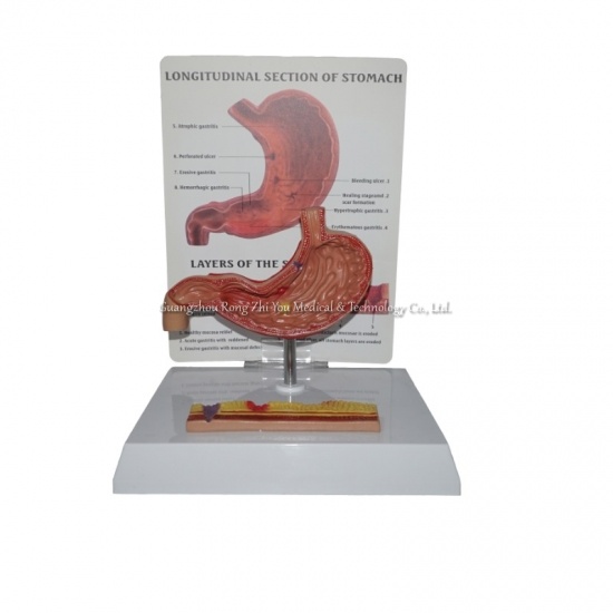 modelo de estómago humano