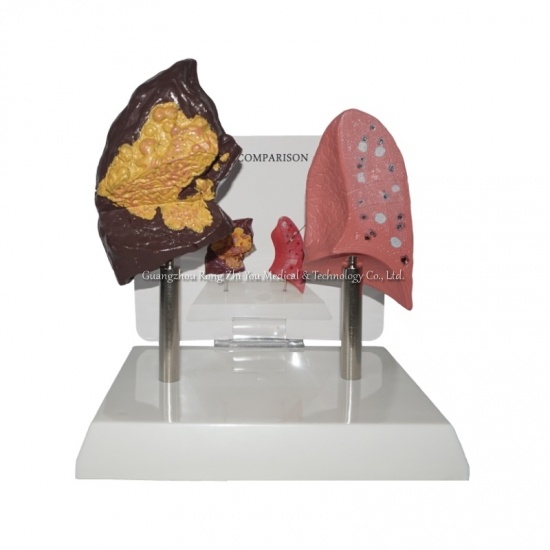 estructura pulmonar modelo anatómico